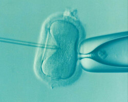 improve your ivf cycle